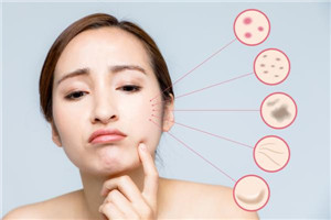 為什么皮膚白不起來(lái) 為什么皮膚有時(shí)候白有時(shí)候黑