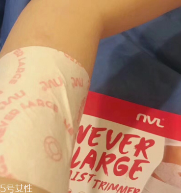 瘦身貼哪個(gè)效果好？好用的瘦身貼推薦