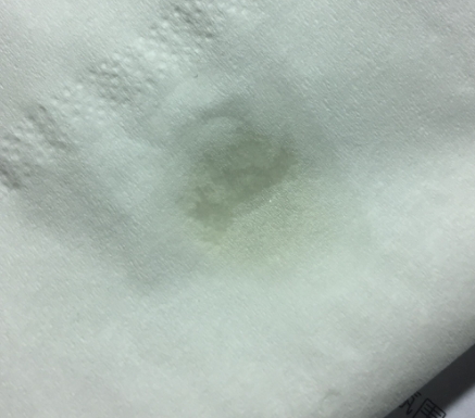 天竺葵精油可以去黑頭嗎？天竺葵精油怎么去黑頭