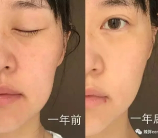 童顏機(jī)有用嗎？童顏機(jī)的功效