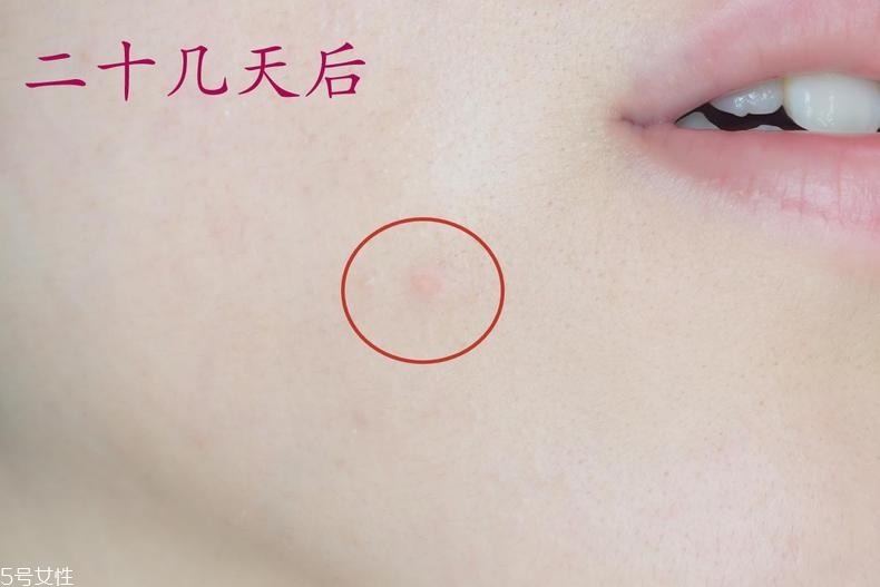 雅詩蘭黛晶透沁白防曬搖搖乳成膜快嗎？適合油痘皮嗎？