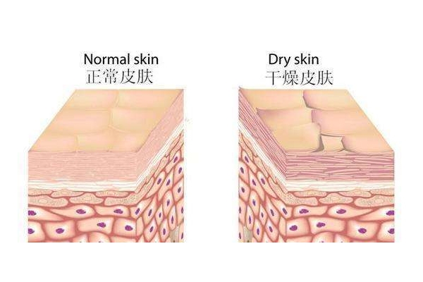 干皮怎么補(bǔ)水 干皮科學(xué)補(bǔ)水三步走 干皮怎么補(bǔ)水 干皮科學(xué)補(bǔ)水三步走