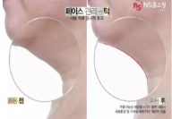 dpc美容儀和雅萌美容儀對比