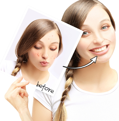 導(dǎo)出儀器真的有用嗎？導(dǎo)出儀的功效