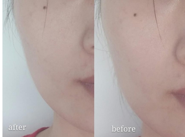 ulike美容儀怎么用？ulike美容儀充電