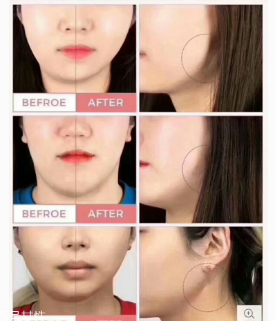 韓國(guó)dodo label隱形瘦臉貼敏感肌能用嗎 注意事項(xiàng) 韓國(guó)dodo label隱形瘦臉貼敏感肌能用嗎 注意事項(xiàng)