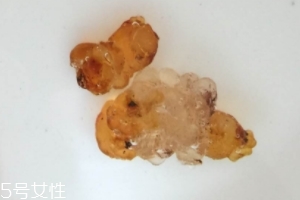 桃膠可以用開水泡嗎？用開水泡桃膠好嗎？