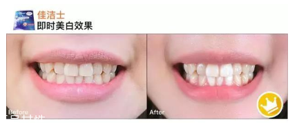 佳潔士一天美白牙貼真的能美白嗎 佳潔士美白牙貼評(píng)測(cè) 佳潔士一天美白牙貼真的能美白嗎 佳潔士美白牙貼評(píng)測(cè)