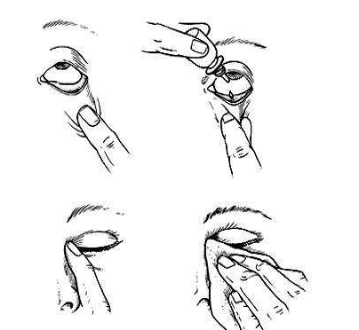 眼藥水兒童可以用嗎？眼藥水適合兒童用嗎？