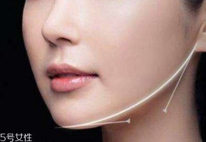 粉毒瘦臉針能維持多久？粉毒瘦臉針能保持多長時(shí)間