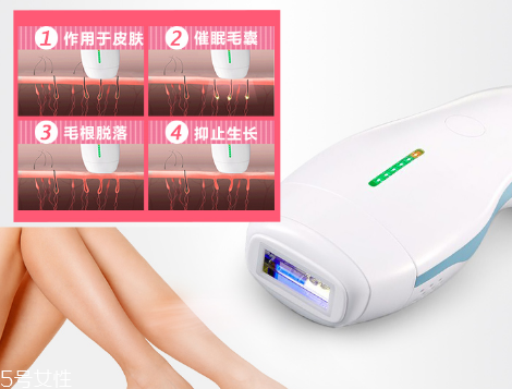 deess脫毛儀多少錢(qián)？蒂絲脫毛儀價(jià)格