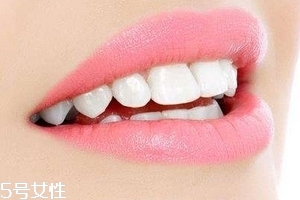 超聲波潔牙牙齒會(huì)變白嗎？超聲波潔牙心得