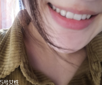 超聲波潔牙牙齒會(huì)變白嗎？超聲波潔牙心得