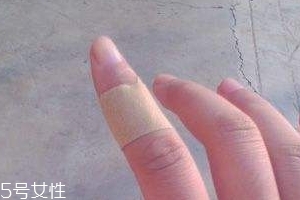 創(chuàng)可貼可以消腫嗎？創(chuàng)可貼有消腫功效嗎？