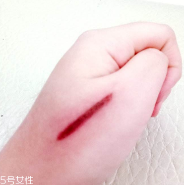 創(chuàng)可貼和肉連著怎么辦？創(chuàng)可貼連著肉怎么處理？