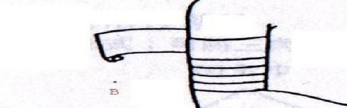 醫(yī)用紗布怎么固定？醫(yī)用紗布怎么包扎？