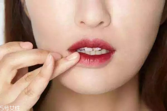 唇部周圍暗沉怎么辦 唇周暗沉如何改善 唇部周圍暗沉怎么辦 唇周暗沉如何改善