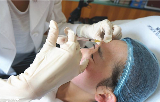 瑞藍(lán)二號玻尿酸能維持多久 瑞藍(lán)2號和3號的區(qū)別 瑞藍(lán)二號玻尿酸能維持多久 瑞藍(lán)2號和3號的區(qū)別