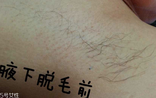 雅萌脫毛儀閃燈次數(shù)是多少 雅萌脫毛儀的使用壽命 雅萌脫毛儀閃燈次數(shù)是多少 雅萌脫毛儀的使用壽命