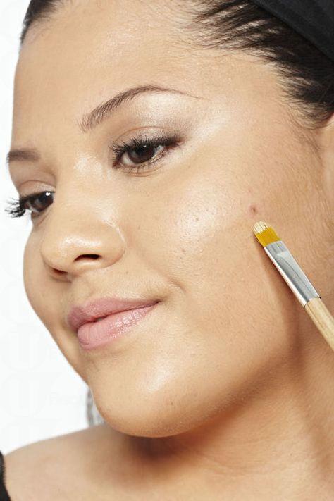 下巴上長痘怎么治 5個非藥膏方法 下巴上長痘怎么治 5個非藥膏方法