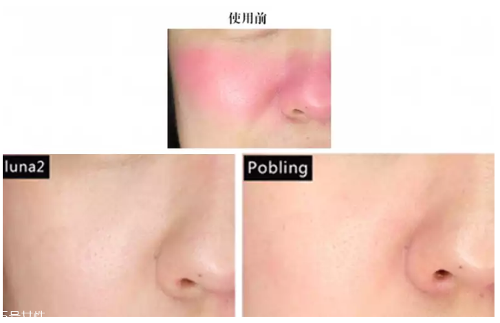 pobling和luna哪個(gè)好 pobling震動(dòng)潔面儀和luna mini2對(duì)比評(píng)測(cè)