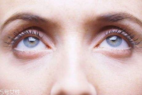 去眼袋手術幾天拆線好 去眼袋最永久的方法