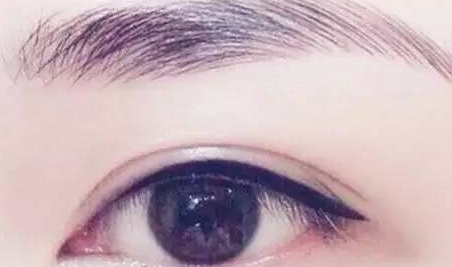 提眉和雙眼皮一起做嗎？提眉和雙眼皮要隔開多久