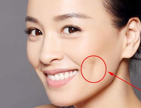 人造酒窩不笑也有嗎？人造酒窩自然嗎