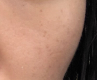 倩碧和蘭芝哪個(gè)檔次高？倩碧和蘭芝選擇