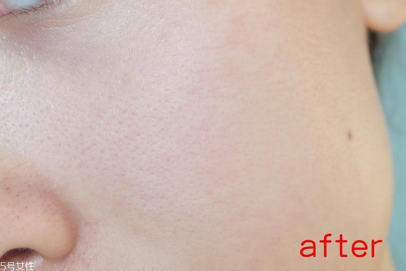 radha beauty vc精華白天能用嗎？敏感肌能用嗎？