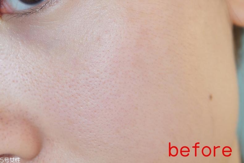 radha beauty vc精華白天能用嗎？敏感肌能用嗎？