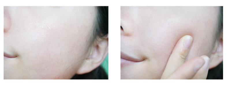 嬌韻詩(shī)不死鳥(niǎo)水精華適合夏天嗎 嬌韻詩(shī)不死鳥(niǎo)水精華評(píng)測(cè) 嬌韻詩(shī)不死鳥(niǎo)水精華適合夏天嗎 嬌韻詩(shī)不死鳥(niǎo)水精華評(píng)測(cè)