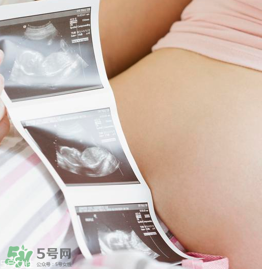 頭胎雙胞胎還能生二胎嗎？雙胞胎家庭能要二胎嗎？