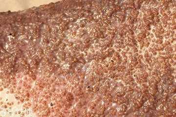 海藻面膜能去黑頭嗎？海藻面膜有去黑頭功效嗎？