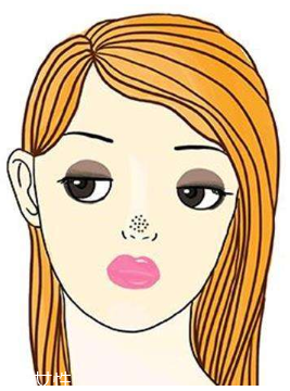 黑頭不管它會變大嗎？黑頭不管它會怎樣？