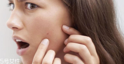 頑固痘痘怎么消除？油皮為什么反復(fù)爆痘？