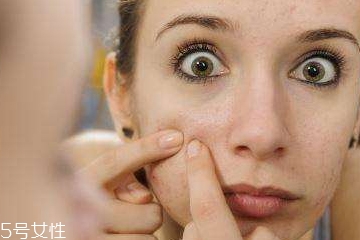 頑固痘痘怎么消除？油皮為什么反復(fù)爆痘？