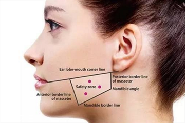瘦臉針適合哪種臉型 瘦臉針適合多大年紀打