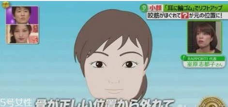 橡皮筋綁耳朵每天用嗎 橡皮筋綁耳朵瘦臉法操作方法 橡皮筋綁耳朵每天用嗎 橡皮筋綁耳朵瘦臉法操作方法