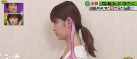 橡皮筋綁耳朵每天用嗎 橡皮筋綁耳朵瘦臉法操作方法 橡皮筋綁耳朵每天用嗎 橡皮筋綁耳朵瘦臉法操作方法