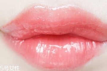 嘟嘟唇可以接吻嗎 恢復(fù)后就可以 嘟嘟唇可以接吻嗎 恢復(fù)后就可以