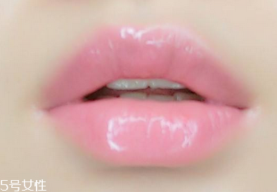 嘟嘟唇可以接吻嗎 恢復(fù)后就可以 嘟嘟唇可以接吻嗎 恢復(fù)后就可以