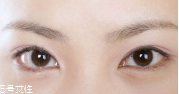 割雙眼皮后多久消腫呢 每個(gè)人的消腫時(shí)間不一樣 割雙眼皮后多久消腫呢 每個(gè)人的消腫時(shí)間不一樣