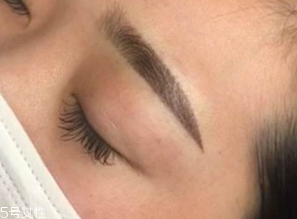 紋眉吃蝦了怎么辦 忍一段時(shí)間 紋眉吃蝦了怎么辦 忍一段時(shí)間