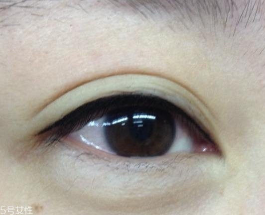 美瞳線會(huì)腫幾天 不超過(guò)一周