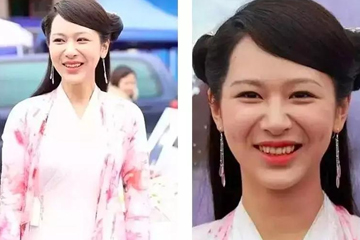 法令紋明顯什么原因 6個(gè)原因讓你少年老成