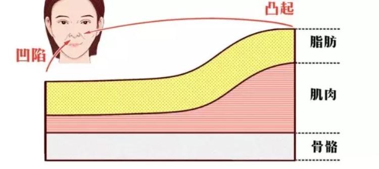 法令紋明顯什么原因 6個(gè)原因讓你少年老成