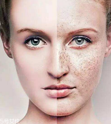 皮秒會反黑嗎 這是正?，F象