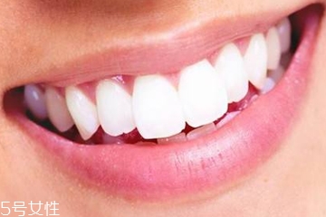 牙膏潔凈劑有哪些 2種成分會加重口腔潰瘍 牙膏潔凈劑有哪些 2種成分會加重口腔潰瘍