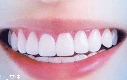 牙膏潔凈劑有哪些 2種成分會加重口腔潰瘍 牙膏潔凈劑有哪些 2種成分會加重口腔潰瘍